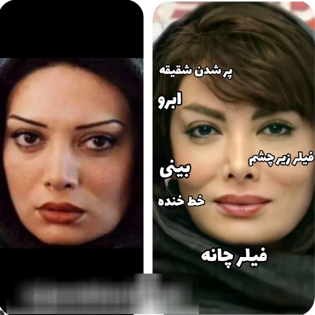 عمل های زیبایی احتمالی نگار فروزنده