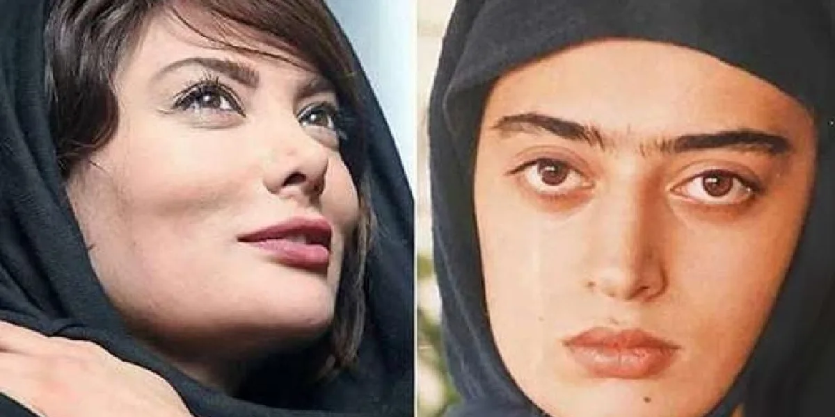 نگار فروزنده قبل و بعد عمل بینی