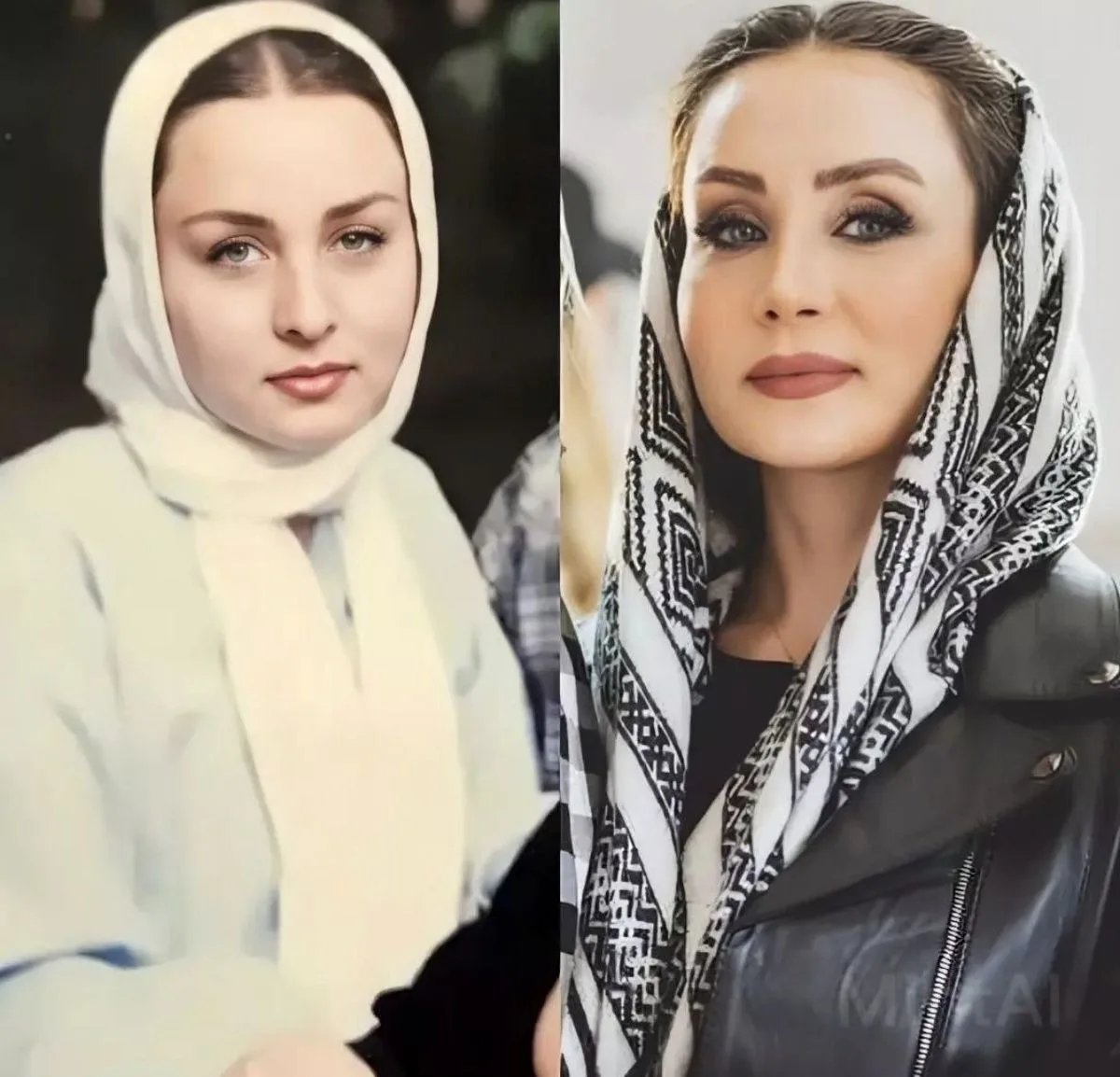 حدیث فولادوند قبل از عمل‌های زیبایی صورت