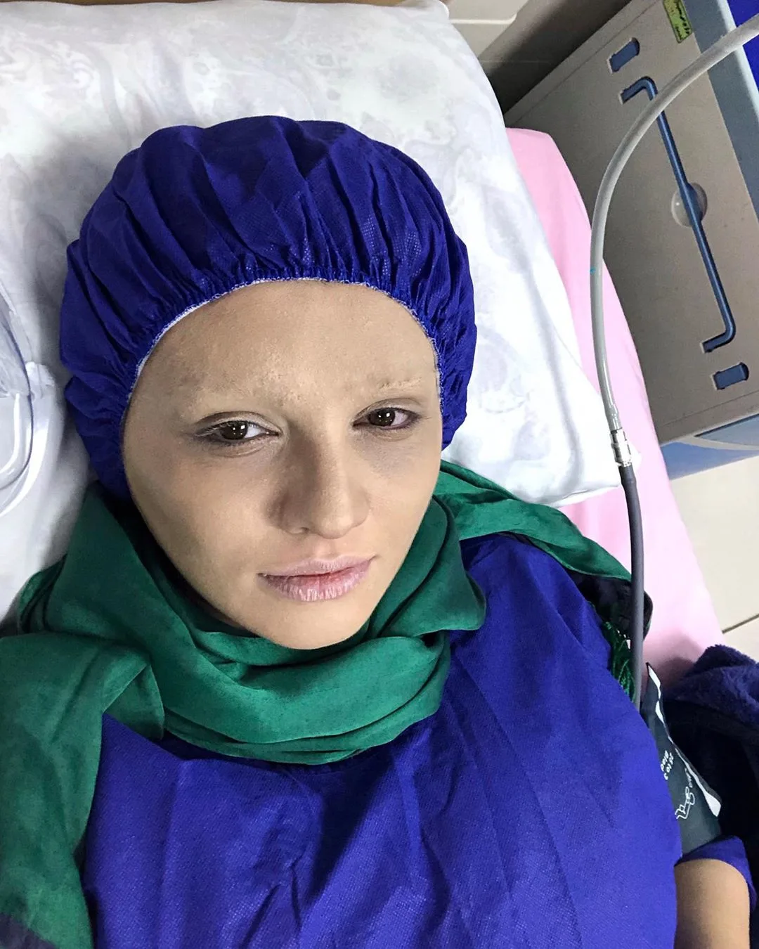 سیما خضرآبادی با گریم بیمار سرطانی