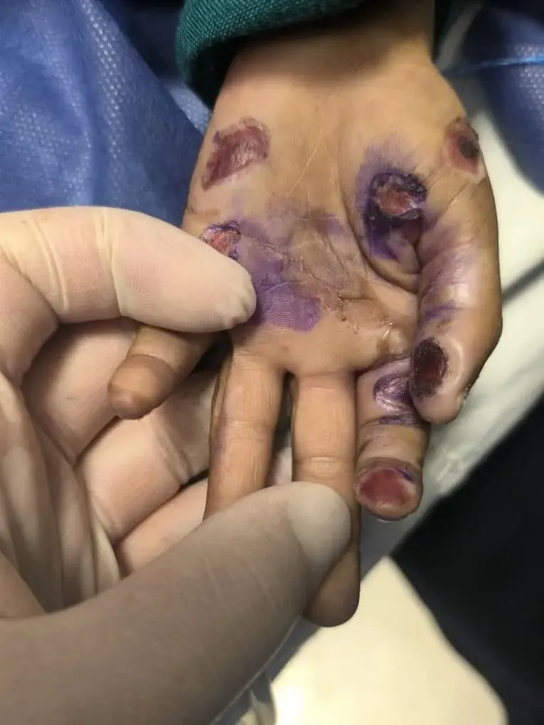 امیرعباس رونما کودک ۴ ساله هرمزگانی که بود؟ + عکس امیرعباس رونما کودک ۴ ساله هرمزگانی که بود؟ + عکس