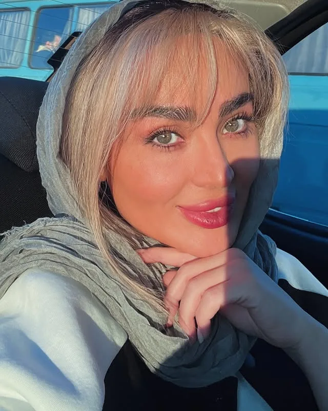 تصاویر و بیوگرافی سولماز آقمقانی بازیگر سینما و تلویزیون چهره جدید سولماز آقمقانی با عمل های زیبایی متعدد