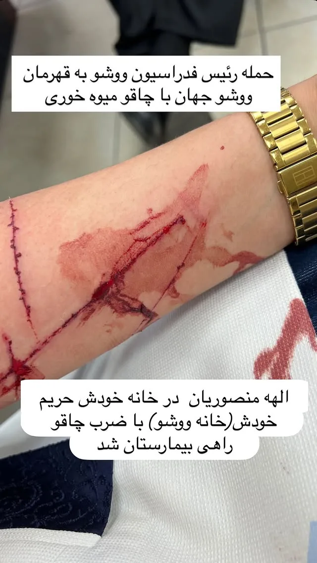 ماجرای درگیری خواهران منصوریان در فدراسیون ووشو، چاقوکشی و واقعیت ماجرا چاقو خوردن الهه منصوریان